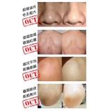 ALEPIA 陳年古皂 - 橄欖油、含1% 月桂油